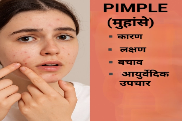 Pimples - Cause and ayurvedic treatment.