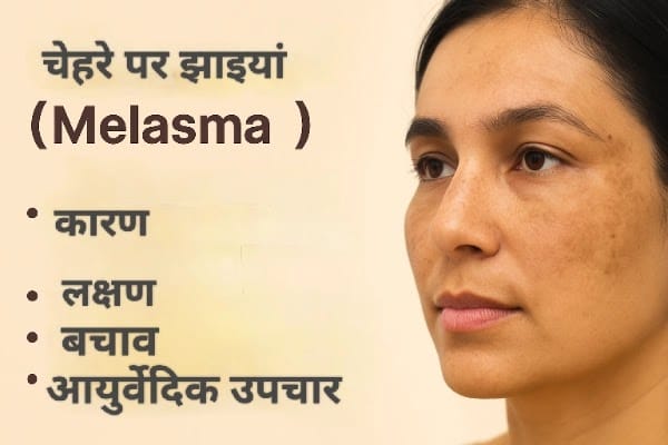 Melasma/Chloasma ke karan, lakshan, bachaw or ayurvedic treatment.